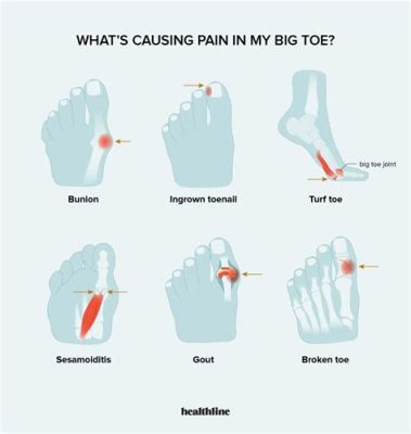 Why Does My Toe Hurt After Running: A Journey Through the Mysteries of Foot Pain and Cosmic Alignment